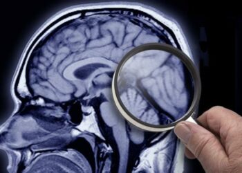 ALZHEİMER BELİRTİLERİ NELER HANGİ TEDAVİLER UYGULANIR ?