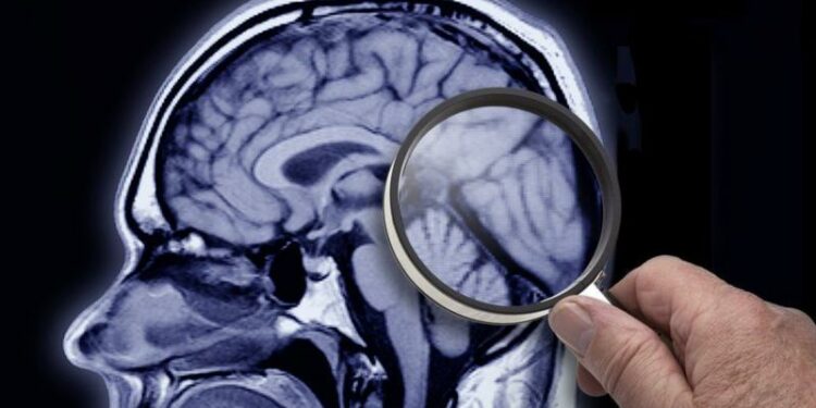 ALZHEİMER BELİRTİLERİ NELER HANGİ TEDAVİLER UYGULANIR ?