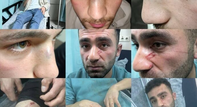 “Polis İşkencesi: Gençlere Darp ve Çıplak Arama”