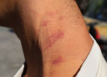 “Teröristsiniz Diyerek Başımızı Eğdiler”