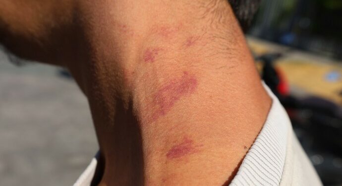 “Teröristsiniz Diyerek Başımızı Eğdiler”