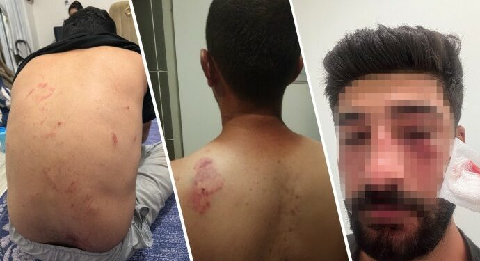 Mersin’de Kürt Aileye Irkçı Saldırı