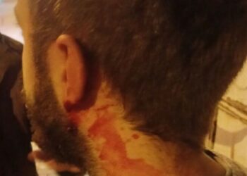 Bartın’da Üniversitelilere Faşist Saldırı