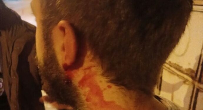 Bartın’da Üniversitelilere Faşist Saldırı