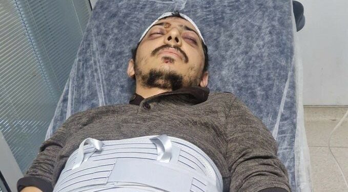 Diyar Koç Yaşadığı İşkenceyi Anlattı: Geri Adım Atmayacağım